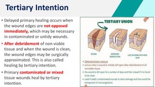 • Delayed primary healing occurs when
the wound edges are not opposed
immediately, which may be necessary
in contaminated or untidy wounds.
• After debridement of non-viable
tissue and when the wound is clean,
the wound edges may be surgically
approximated. This is also called
healing by tertiary intention.
• Primary contaminated or mixed
tissue wounds heal by tertiary
intention.
Tertiary Intention
 