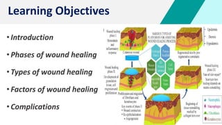 Learning Objectives
•Introduction
•Phases of wound healing
•Types of wound healing
•Factors of wound healing
•Complications
 