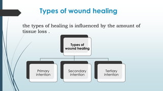 Types of wound healing
the types of healing is influenced by the amount of
tissue loss .
Types of
wound healing
Primary
intention
Secondary
intention
Tertiary
intention
 
