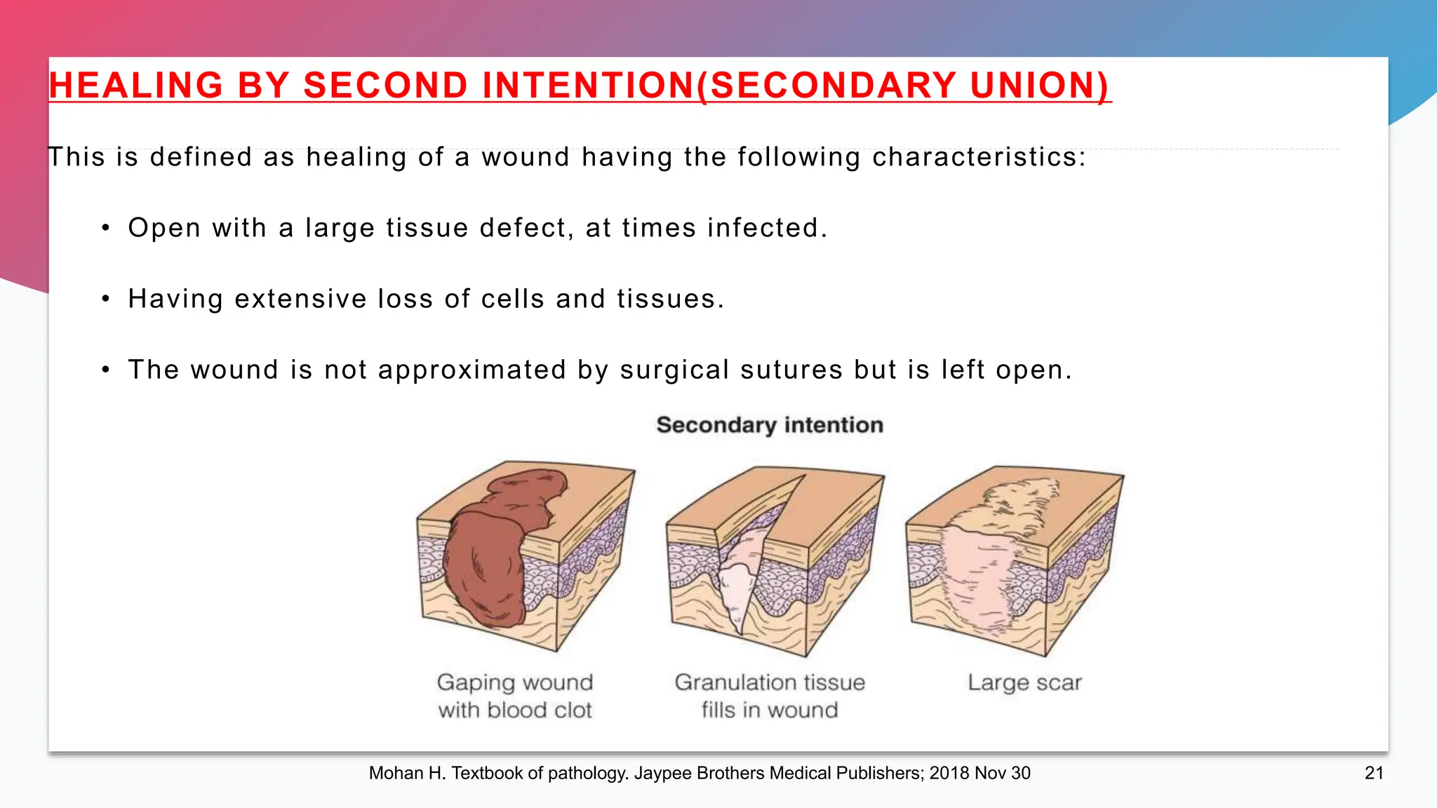 WOUND HEALING. wound healing in general, wound healing in dentistry. | PPTX