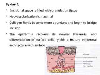 Comprehensive Overview of Wound Healing Processes and Classifications ...