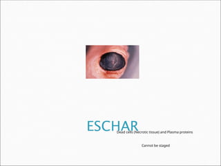 Comprehensive Overview of Skin Anatomy, Wound Healing, and Care in ...