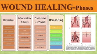 WOUND HEALING-Phases
 