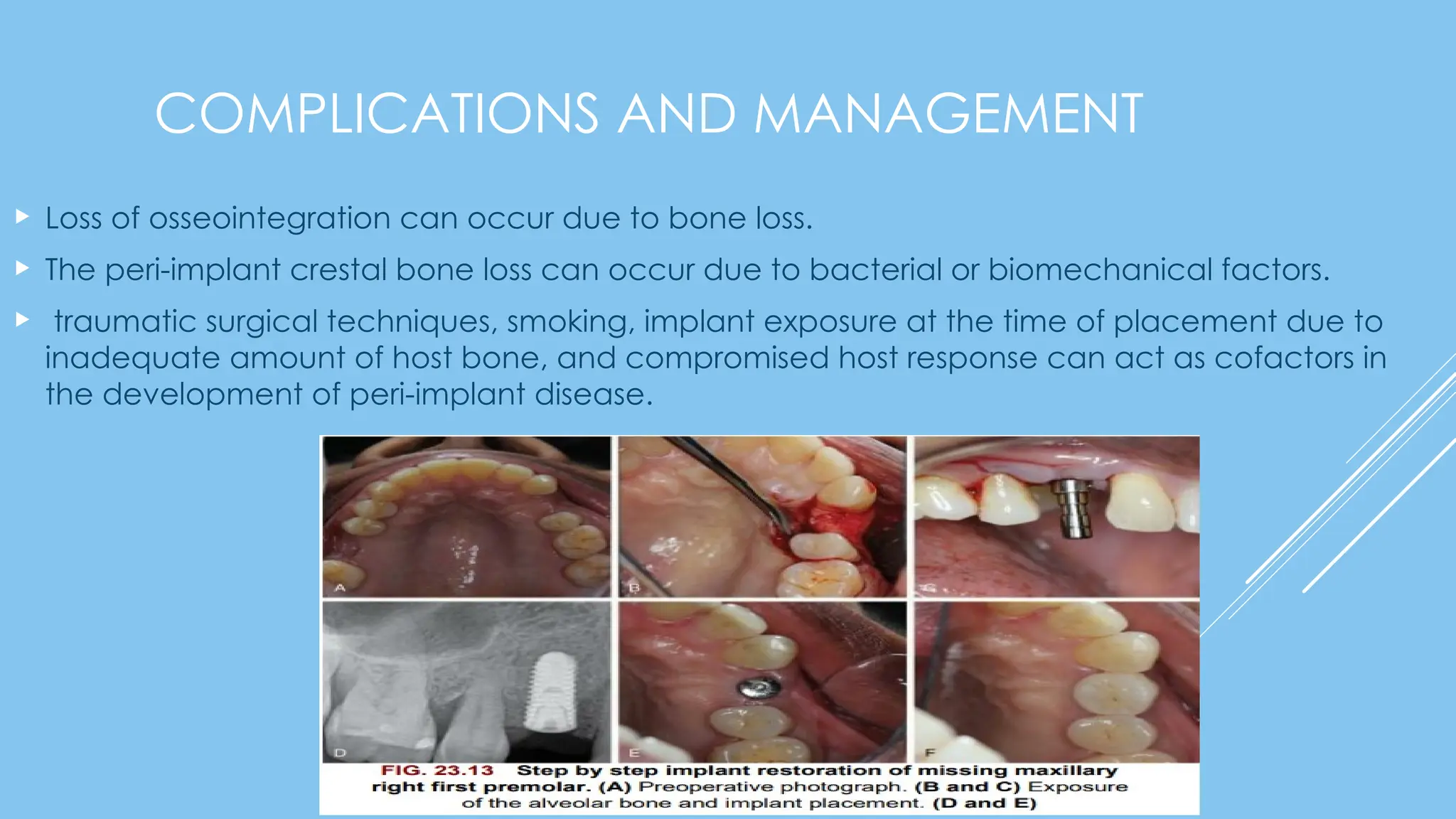 Wound Healing, factors affecting it and its mechanism | PPTX