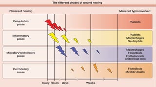 The different phases of wound healing
Phases of healing Main cell types involved
Coagulation
phase
Platelets
Platelets
Macrophages
Neutrophils
Macrophages
Fibroblasts
Epithelial cells
Endothelial cells
Fibroblasts
Myofibroblasts
Injury Hours Days Weeks
Inflammatory
phase
Migratory/proliferative
phase
Remodeling
phase
 