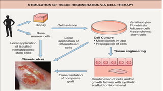 STIMULATION OF TISSUE REGENERATION VIA CELL THERAPY
Chronic ulcer
Cell Culture
• Modification in vitro
• Propagation of cells
Tissue engineering
Combination of cells and/or
growth factors with synthetic
scaffold or biomaterial
Transplantation
of composite
graft
Local application
of isolated
hematopoietic
stem cells
Bone
marrow cells
Cell isolation
Biopsy
Local
application of
differentiated
cells
Keratinocytes
Fibroblasts
Adipose cells
Mesenchymal
stem cells
 