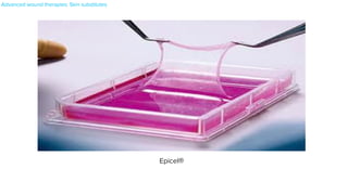 Epicel®
 

Advanced wound therapies: Skin substitutes
 