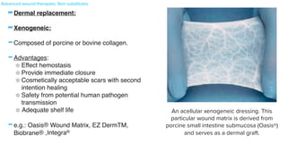 -Dermal replacement
:

-Xenogeneic
:

-Composed of porcine or bovine collagen
.

-Advantages:
 

Effect hemostasis
 

Provide immediate closure
 

Cosmetically acceptable scars with second
intention healin
g

Safety from potential human pathogen
transmissio
n

Adequate shelf lif
e

-e.g.: Oasis® Wound Matrix, EZ DermTM,
Biobrane® ,IntegraR
of both Laserskin® and Celaderm™ are limited, improved healing of
diabetic foot ulcers and venous leg ulcers was noted when compared to
saline gauze59
. These epidermal grafts are also used for partial- and
full-thickness burns.
Dermal replacements
There are two types of dermal replacements: xenogeneic and allogeneic
(Table 145.7). Neither of these is permanent: DNA analysis of wounds
after the application of non-autologous skin substitutes shows almost
complete disappearance of the grafted cells after two months60
. The
goal of these dermal grafts is to provide a temporary biologic dressing
in order to stimulate the healing process. They are placed over the
wound, extending slightly onto normal skin, and then bolstered into
place. Secondary dressings must be applied. The major component of
dermal replacements is collagen; other elements of the extracellular
matrix, e.g. glycosaminoglycans, may be included and in the case of
cellular products, fibroblasts.
Xenogeneic
Although other sources are available, xenogeneic grafts are usually
composed of porcine or bovine collagen (see Table 145.7). The advan-
tages of these products are: (1) their ability to effect hemostasis and to
provide immediate closure as well as cosmetically acceptable scars with
second intention healing; (2) safety from potential human pathogen
transmission due to their animal origin; and (3) an adequate shelf life,
facilitating off-the-shelf access.
Fig. 145.11 An acellular xenogeneic dressing. This particular wound matrix is
derived from porcine small intestine submucosa (Oasis®) and serves as a
dermal graft.
Oasis® Wound Matrix, EZ Derm™, and Biobrane® are examples
of acellular matrices derived from porcine collagen (Fig. 145.11).
They have significant elasticity, enabling a full range of motion of the
covered body part, and there is no requirement for dressing changes
once it has adhered to the wound bed. However, Biobrane® may
An acellular xenogeneic dressing. This
particular wound matrix is derived from
porcine small intestine submucosa (Oasis®)
and serves as a dermal graft.


Advanced wound therapies: Skin substitutes
 