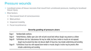 - Localised areas of tissue necrosis that result from unrelieved pressure, leading to localised
tissue injury


- Risk factors:


Decreased level of consciousness


Malnutrition


Impaired mobility


Fecal incontinence
Pressure wounds
Fig4. Thedistributionofcommonpressureulcers.(ReproducedwithpermissionfromPhillips
TJ. Ulcers. Dermatology, vol 2. Philadelphia: Elsevier; 2008: p 1611.)
Table V. Pressure ulcer classification55
Stage I Nonblanchable erythema
Stage II Partial-thickness, shallow open ulcer with red pink wound bed without slough; may present as a blister
Stage III Full-thickness skin loss. Subcutaneous fat may be visible, but bone, tendon or muscle are not exposed;
slough may be present but does not obscure depth of tissue loss; may include undermining and tunneling
Stage IV Full-thickness tissue loss with exposed bone tendon or muscle; slough or eschar may be present; often
includes undermining and tunneling
Severity grading of pressure ulcers
 