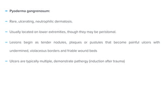 - Pyoderma gangrenosum:


- Rare, ulcerating, neutrophilic dermatosis.


- Usually located on lower extremities, though they may be peristomal.


- Lesions begin as tender nodules, plaques or pustules that become painful ulcers with
undermined, violaceous borders and friable wound beds


- Ulcers are typically multiple, demonstrate pathergy (induction after trauma)
 