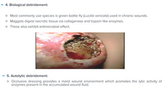 - 4. Biological debridement:


Most commonly use species is green bottle
fl
y (Lucilia sericata) used in chronic wounds.


Maggots digest necrotic tissue via collagenase and trypsin like enzymes.


These also exhibit antimicrobial e
ff
ect.


- 5. Autolytic debridement:


Occlusive dressing provides a moist wound environment which promotes the lytic activity of
enzymes present in the accumulated wound
fl
uid.
 