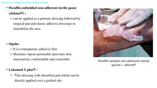 -Paraf
fi
n embedded non-adherent sterile gauze
(Jelonet®)
:

can be applied as a primary dressing followed by
surgical pad and elastic adhesive dressings to
immobilise the are
a

-Opsite:
 

It is a transparent, adhesive
fi
lm.
 

Moisture vapour permeable (prevents skin
maceration), conformable and extensible
.

-Lukomed T plus®
:

Film dressing with absorbent pad which can be
directly applied over a grafted site.
Fig. 4.8. Paraffin embedded nonadherent sterile gauze (Jelonet®
) can be applied as a primary
dressing in miniature punch grafting.
In cellular grafting techniques, primary dressing is done using collagen dressings. After applying the basal layer cell
suspension, collagen sheets are used as primary covers to create a biological environment (Fig. 4.10). Alternatively,
amniotic membrane can also be used (Figs. 4.11A and B). Mepitel dressing is also used in places where collagen sheets
are not available (Figs. 4.12A and B). This is then covered with a sterile pad and finally with Tegaderm (3M) dressing.
Nail Surgeries
In nail surgery, the postoperative dressings must have these properties: nonadherent, absorbent, perfectly fixed and
with adequate pressure to prevent bleeding.
Application of an antiseptic ointment covered with a paraffin embedded nonadherent sterile gauze (Jelonet®
,
Bactigrass®
, Sofratulle®
) as a first layer will protect the wound from drying and will allow easy and painless removal.
Mepitel®
is another nonabsorbent, porous, semitransparent flexible poyamide net, silicon- coated dressing useful as a
primary dressing in nail surgeries and cellular grafting surgeries in vitiligo.
Para
ffi
n embed non adherent sterile
gauze— JelonetR
Choosing a suitable dressing: Vitiligo surgery
 