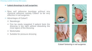 - Latest dressings in nail surgeries:


- New self adhesive bandage without any
chemical adhesive namely CobanR to be very
e
ff
ective in nail surgeries.


- Advantages of CobanR:


Nonallergic


Can be easily reapplied if patient feels the
dressing is too tight without disturbing the
inner layers of the dressing.


Stretchable


Suitable for pressure dressing
Dressings in Dermatosurgery
Figs. 4.13 A to D. Coban®
dressings in nail surgeries.
18
- 19-July-2019 10:25:15
Dressings in Dermatosurgery
Figs. 4.13 A to D. Coban®
dressings in nail surgeries.
18
- 19-July-2019 10:25:15
Dressings in Dermatosurgery
Figs. 4.13 A to D. Coban®
dressings in nail surgeries.
18
- 19-July-2019 10:25:15
Dressings in Dermatosurgery
Figs. 4.13 A to D. Coban®
dressings in nail surgeries.
18
- 19-July-2019 10:25:15
CobanR dressing in nail surgeries
Choosing a suitable dressing: Nail surgery
 