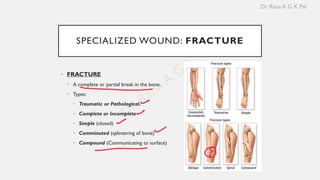 Splintery Fractures Example Comprehensive Overview of Wound Healing, Repair, and Fracture Healing ...
