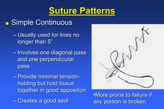 Simple Continuous Pattern Surgery Wound Healing and Suture Knowledge-Kim_Bayer.ppt