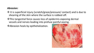 Abrasion:
 It is superficial injury (scratch/graze/pressure/ contact) and is due to
shearing of the skin where the surface is rubbed off.
This tangential force causes loss of epidermis exposing dermal
vessels and nerves leading into profuse painful oozing.
Abrasion heals by epithelialization.
 