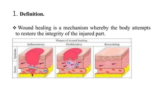 1. Definition.
 Wound healing is a mechanism whereby the body attempts
to restore the integrity of the injured part.
 