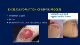 EXCESSIVE FORMATION OF REPAIR PROCESS
•
•
•
 