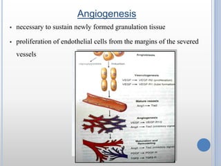 fibrogenesis
 Emigration and proliferation of the fibroblasts at the site of injury
 Deposition of these cells which in ...