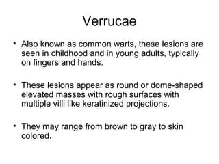 Verrucae
• Also known as common warts, these lesions are
seen in childhood and in young adults, typically
on fingers and hands.
• These lesions appear as round or dome-shaped
elevated masses with rough surfaces with
multiple villi like keratinized projections.
• They may range from brown to gray to skin
colored.
 