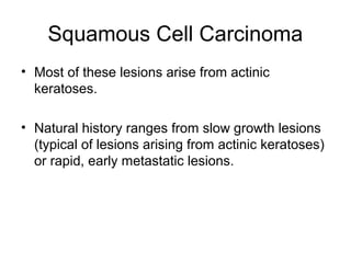 Squamous Cell Carcinoma
• Most of these lesions arise from actinic
keratoses.
• Natural history ranges from slow growth lesions
(typical of lesions arising from actinic keratoses)
or rapid, early metastatic lesions.
 