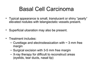 Basal Cell Carcinoma
• Typical appearance is small, translucent or shiny “pearly”
elevated nodules with telangiectatic vessels present.
• Superficial ulceration may also be present.
• Treatment includes:
– Curettage and electrodessication with ~ 3 mm free
margin
– Surgical excision with 3-5 mm free margin
– X-ray therapy for difficult to reconstruct areas
(eyelids, tear ducts, nasal tip)
 