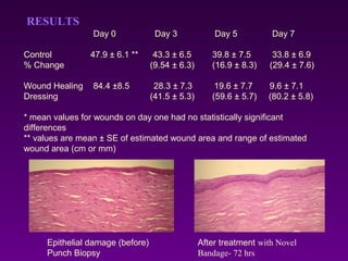 Day 0 Day 3 Day 5 Day 7
Control 47.9 ± 6.1 ** 43.3 ± 6.5 39.8 ± 7.5 33.8 ± 6.9
% Change (9.54 ± 6.3) (16.9 ± 8.3) (29.4 ± 7.6)
Wound Healing 84.4 ±8.5 28.3 ± 7.3 19.6 ± 7.7 9.6 ± 7.1
Dressing (41.5 ± 5.3) (59.6 ± 5.7) (80.2 ± 5.8)
* mean values for wounds on day one had no statistically significant
differences
** values are mean ± SE of estimated wound area and range of estimated
wound area (cm or mm)
Epithelial damage (before)
Punch Biopsy
After treatment with Novel
Bandage- 72 hrs
RESULTS
 