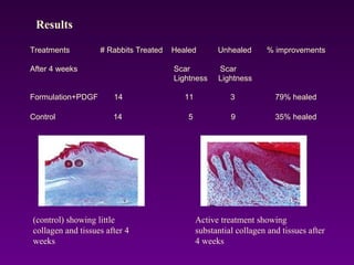 Treatments # Rabbits Treated Healed Unhealed % improvements
After 4 weeks Scar Scar
Lightness Lightness
Formulation+PDGF 14 11 3 79% healed
Control 14 5 9 35% healed
(control) showing little
collagen and tissues after 4
weeks
Active treatment showing
substantial collagen and tissues after
4 weeks
Results
 