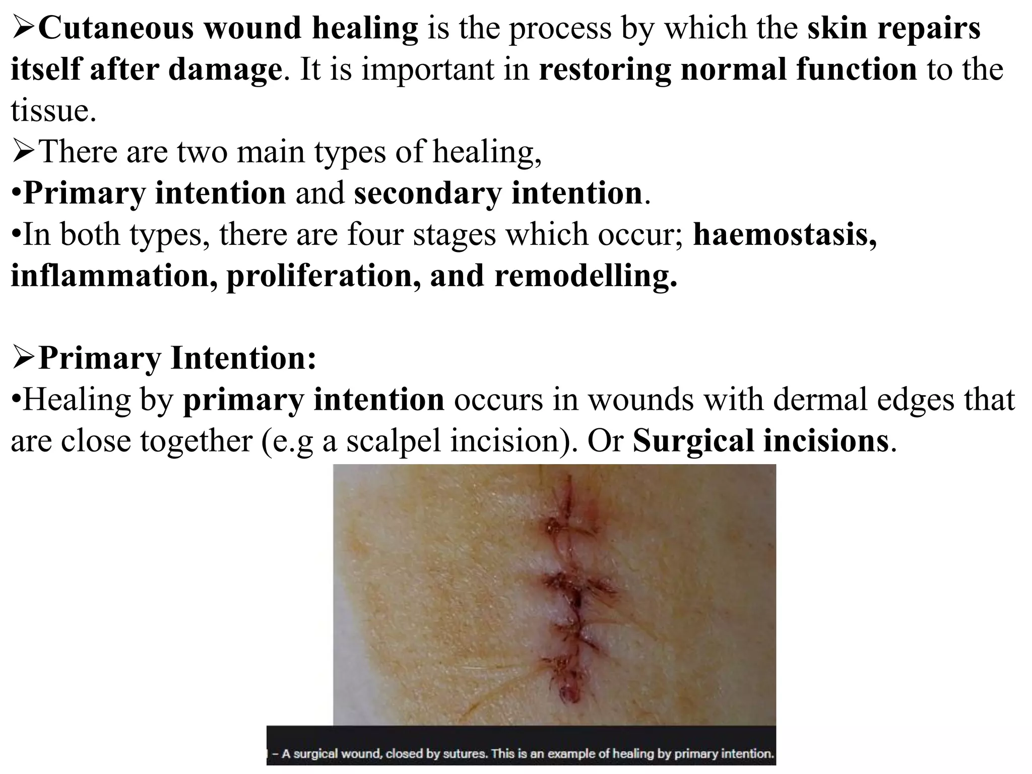 wound healing primary and secondary intention.pdf