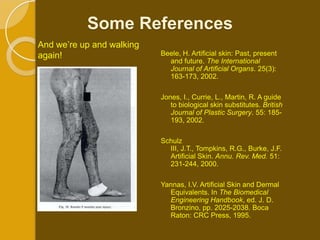 Some References
And we’re up and walking
again!                     Beele, H. Artificial skin: Past, present
                             and future. The International
                             Journal of Artificial Organs. 25(3):
                             163-173, 2002.

                           Jones, I., Currie, L., Martin, R. A guide
                              to biological skin substitutes. British
                              Journal of Plastic Surgery. 55: 185-
                              193, 2002.

                           Schulz
                             III, J.T., Tompkins, R.G., Burke, J.F.
                             Artificial Skin. Annu. Rev. Med. 51:
                             231-244, 2000.

                           Yannas, I.V. Artificial Skin and Dermal
                             Equivalents. In The Biomedical
                             Engineering Handbook, ed. J. D.
                             Bronzino, pp. 2025-2038. Boca
                             Raton: CRC Press, 1995.
 