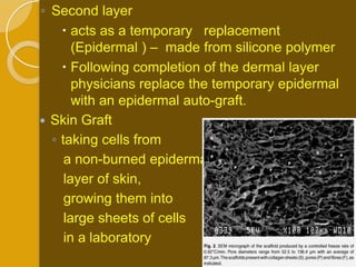◦ Second layer
     acts as a temporary replacement
       (Epidermal ) – made from silicone polymer
     Following completion of the dermal layer
       physicians replace the temporary epidermal
       with an epidermal auto-graft.
 Skin Graft
  ◦ taking cells from
     a non-burned epidermal
     layer of skin,
     growing them into
     large sheets of cells
     in a laboratory
 