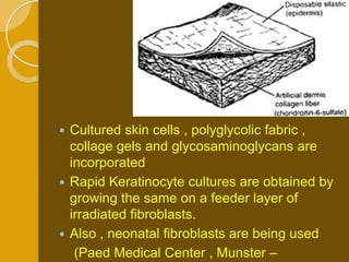  Cultured skin cells , polyglycolic fabric ,
  collage gels and glycosaminoglycans are
  incorporated
 Rapid Keratinocyte cultures are obtained by
  growing the same on a feeder layer of
  irradiated fibroblasts.
 Also , neonatal fibroblasts are being used
   (Paed Medical Center , Munster –
 