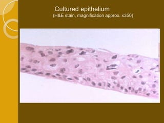 Cultured epithelium
(H&E stain, magnification approx. x350)
 