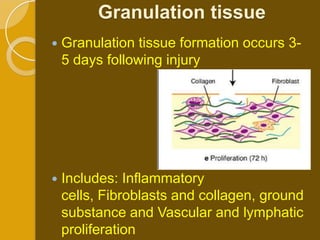 Granulation tissue
   Granulation tissue formation occurs 3-
    5 days following injury




   Includes: Inflammatory
    cells, Fibroblasts and collagen, ground
    substance and Vascular and lymphatic
    proliferation
 
