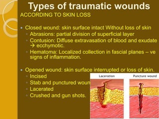Types of traumatic wounds
ACCORDING TO SKIN LOSS

   Closed wound: skin surface intact Without loss of skin
    ◦ Abrasions: partial division of superficial layer
    ◦ Contusion: Diffuse extravasation of blood and exudate
       ecchymotic.
    ◦ Hematoma: Localized collection in fascial planes – ve
      signs of inflammation.

   Opened wound: skin surface interrupted or loss of skin.
    ◦ Incised
    ◦ Stab and punctured wound
    ◦ Lacerated
    ◦ Crushed and gun shots.
 