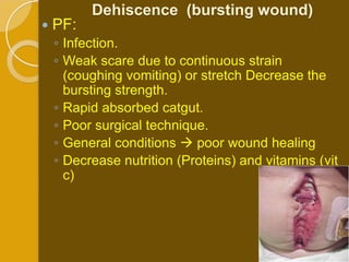 Dehiscence (bursting wound)
   PF:
    ◦ Infection.
    ◦ Weak scare due to continuous strain
      (coughing vomiting) or stretch Decrease the
      bursting strength.
    ◦ Rapid absorbed catgut.
    ◦ Poor surgical technique.
    ◦ General conditions  poor wound healing
    ◦ Decrease nutrition (Proteins) and vitamins (vit
      c)
 