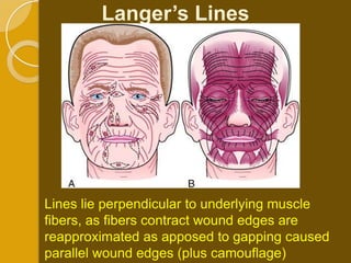 Langer’s Lines




Lines lie perpendicular to underlying muscle
fibers, as fibers contract wound edges are
reapproximated as apposed to gapping caused
parallel wound edges (plus camouflage)
 