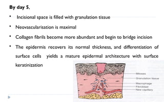 wound healing and types of wound healing and soft tissue and hardtissue ...