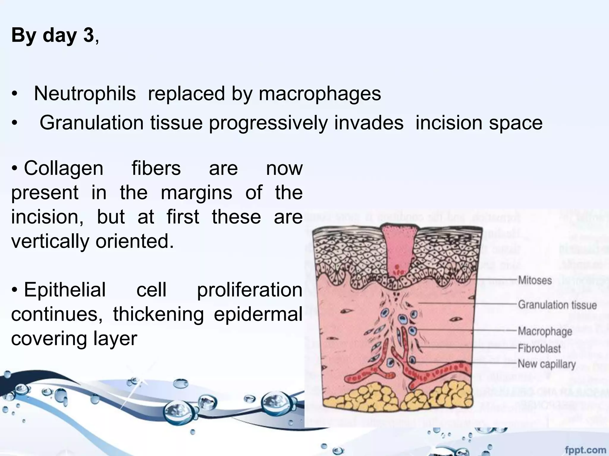 Wound healing Biology Diagrams