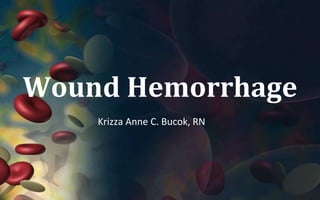 Wound Hemorrhage
    Krizza Anne C. Bucok, RN
 