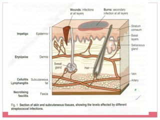 wound-infection-diagram