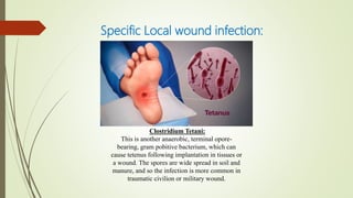 Specific Local wound infection:
Clostridium Tetani:
This is another anaerobic, terminal opore-
bearing, gram pobitive bacterium, which can
cause tetenus following implantation in tissues or
a wound. The spores are wide spread in soil and
manure, and so the infection is more common in
traumatic civilion or military wound.
 