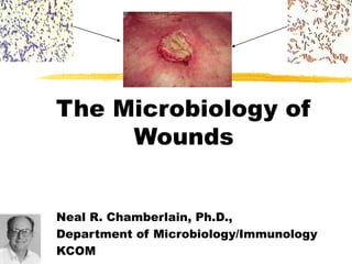 The Microbiology of
Wounds
Neal R. Chamberlain, Ph.D.,
Department of Microbiology/Immunology
KCOM
 