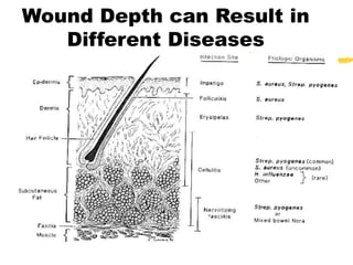 Wound Depth can Result in
Different Diseases
 