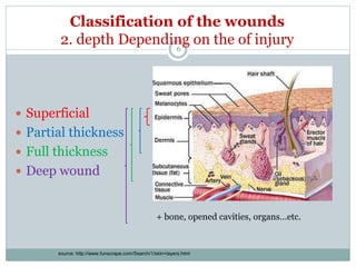 Information on Wound | PPTX | First Aid | Injuries
