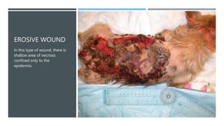 EROSIVE WOUND
In this type of wound, there is
shallow area of necrosis
confined only to the
epidermis.
 