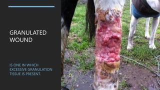 GRANULATED
WOUND
IS ONE IN WHICH
EXCESSIVE GRANULATION
TISSUE IS PRESENT.
 