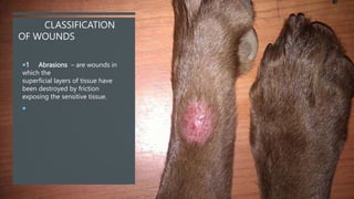 CLASSIFICATION
OF WOUNDS
1 Abrasions – are wounds in
which the
superficial layers of tissue have
been destroyed by friction
exposing the sensitive tissue.

 