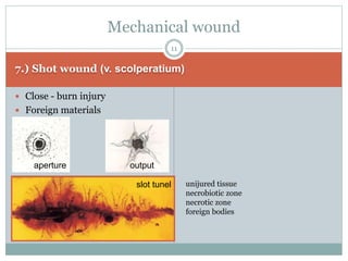 7.) Shot wound (v. scolperatium)
 Close - burn injury
 Foreign materials
Mechanical wound
11
unijured tissue
necrobiotic zone
necrotic zone
foreign bodies
aperture
slot tunel
output
 