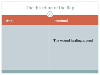 Distal Proximal
The wound healing is good
The direction of the flap
13
 